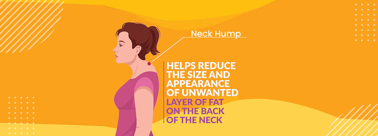 neckhumptreatment